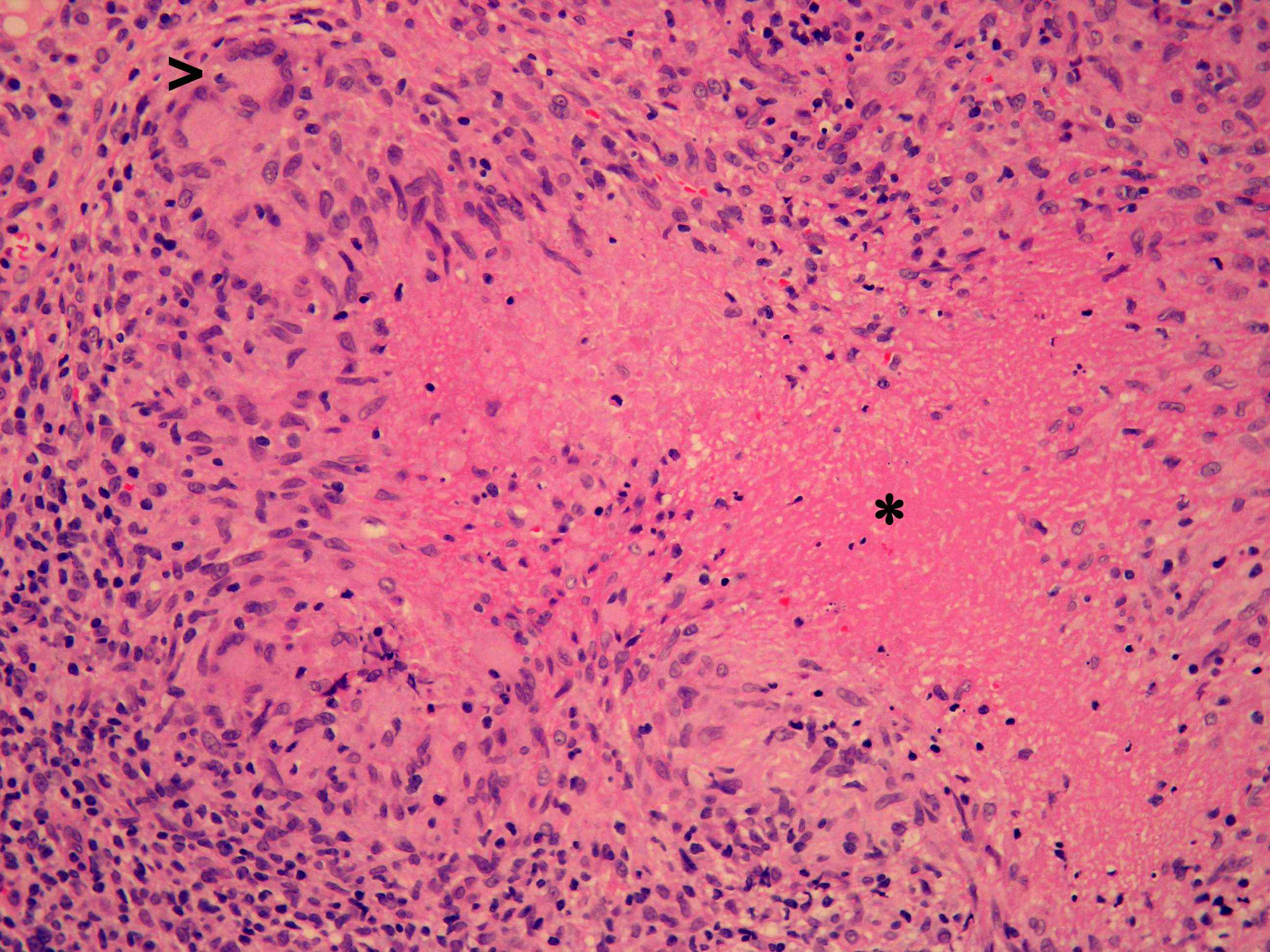 fig 1 f1